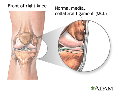 Ligamento Colateral Medial - LCM - Dr Rafael De Luca de Lucena - Porto Alegre - Gravatai - Rio Grande do Sul - Cirurgia - Procedimento - Tratamento - Artrose - Convenio - Especialista - Ortopedista - Desgaste - Preco - Valor - Atuais - Amil - Bradesco - Ipe - Sulamerica - Saudepas - Saude Caixa - Doctor Clin - 