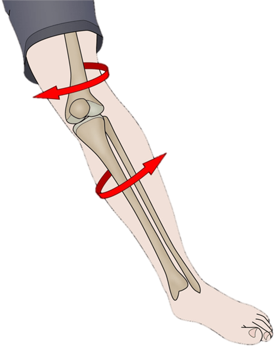 Ligamento Colateral Medial - LCM - Dr Rafael De Luca de Lucena - Porto Alegre - Gravatai - Rio Grande do Sul - Cirurgia - Procedimento - Tratamento - Artrose - Convenio - Especialista - Ortopedista - Desgaste - Preco - Valor - Atuais - Amil - Bradesco - Ipe - Sulamerica - Saudepas - Saude Caixa - Doctor Clin - 