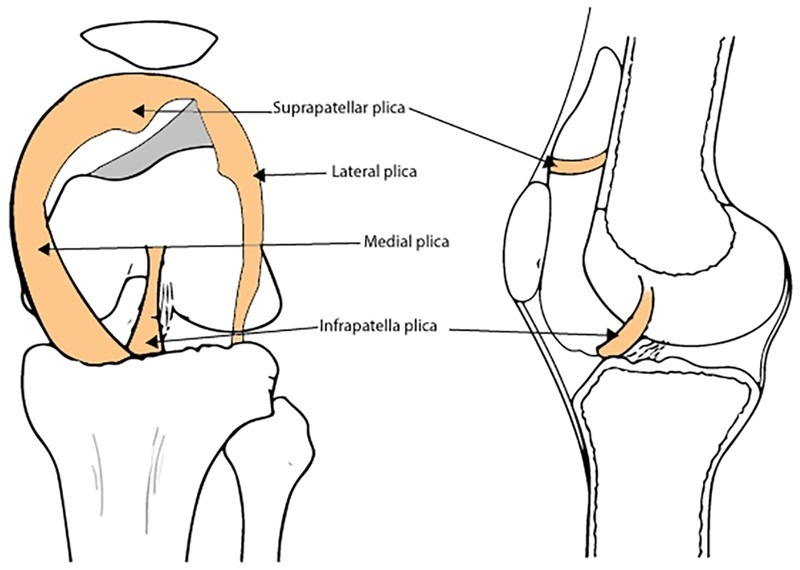 plica sinovial