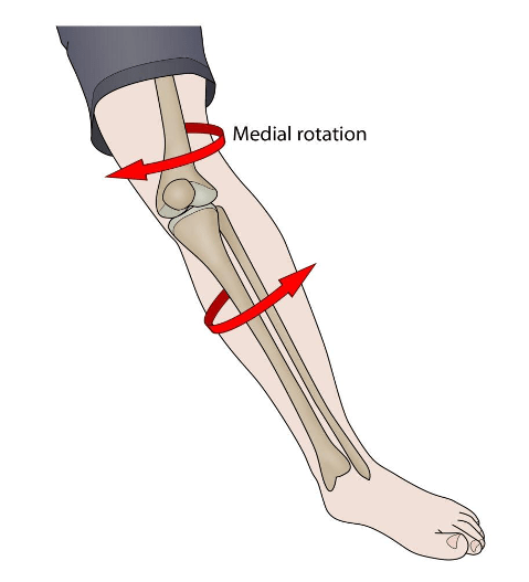 Ruptura do Ligamento Cruzado Anterior - LCA - Dr Rafael De Luca de Lucena - Porto Alegre - Gravatai - Rio Grande do Sul