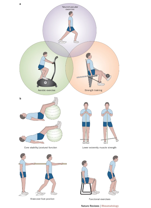 Infiltração Joelho - Dr Rafael De Luca de Lucena - Porto Alegre - Gravatai - Rio Grande do Sul - Tratamento - Convenio - Especialista - Ortopedista - Synolis - Synvisc - Monovisc - Reviscon - Suprahyal - Osteonil - Bradesco
