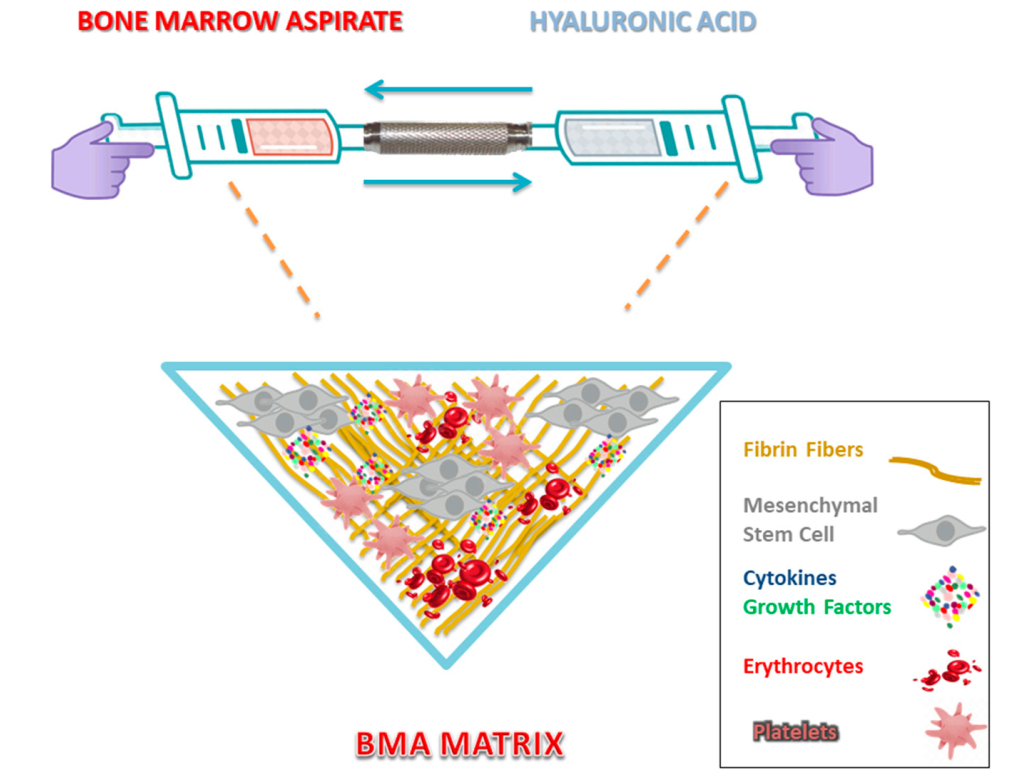 preparação bma matrix