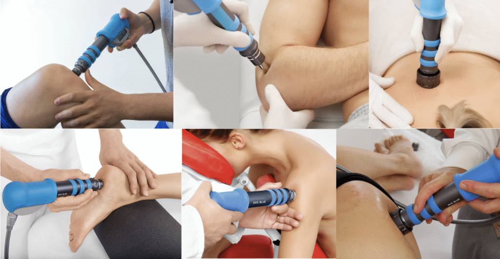 terapia por onda de choque articulações