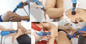 terapia por onda de choque articulações