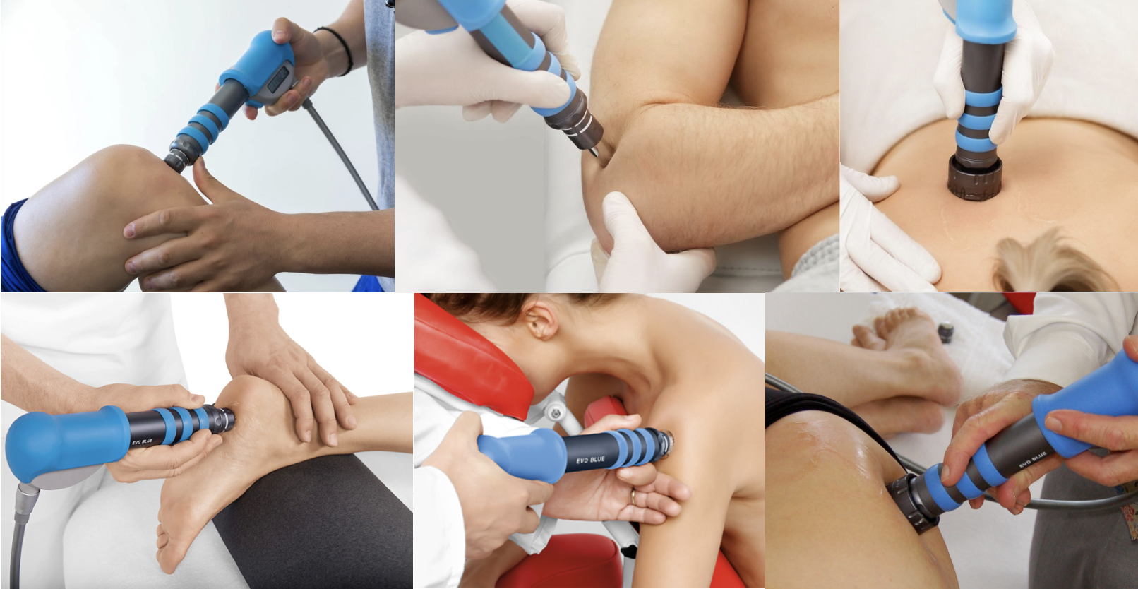 terapia por onda de choques nas articulações terapia por onda de choque articulações