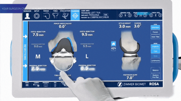 Protese robótica de joelho em porto alegre Protese robótica de joelho em porto alegre