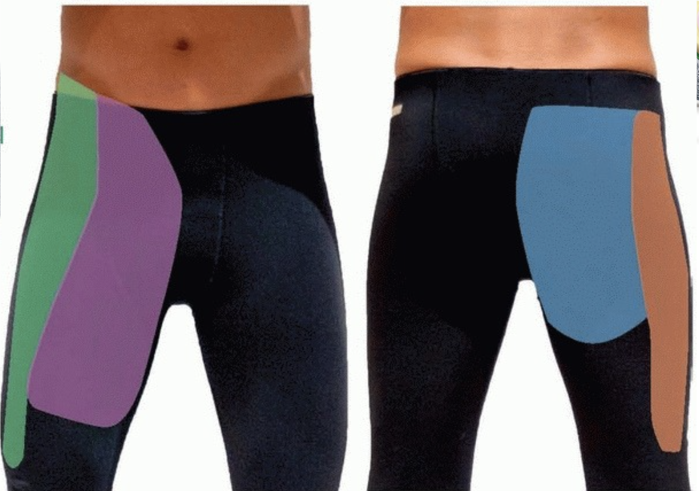 Dor no Quadril Porto Alegre e Gravatai Dor no Quadril Porto Alegre e Gravatai