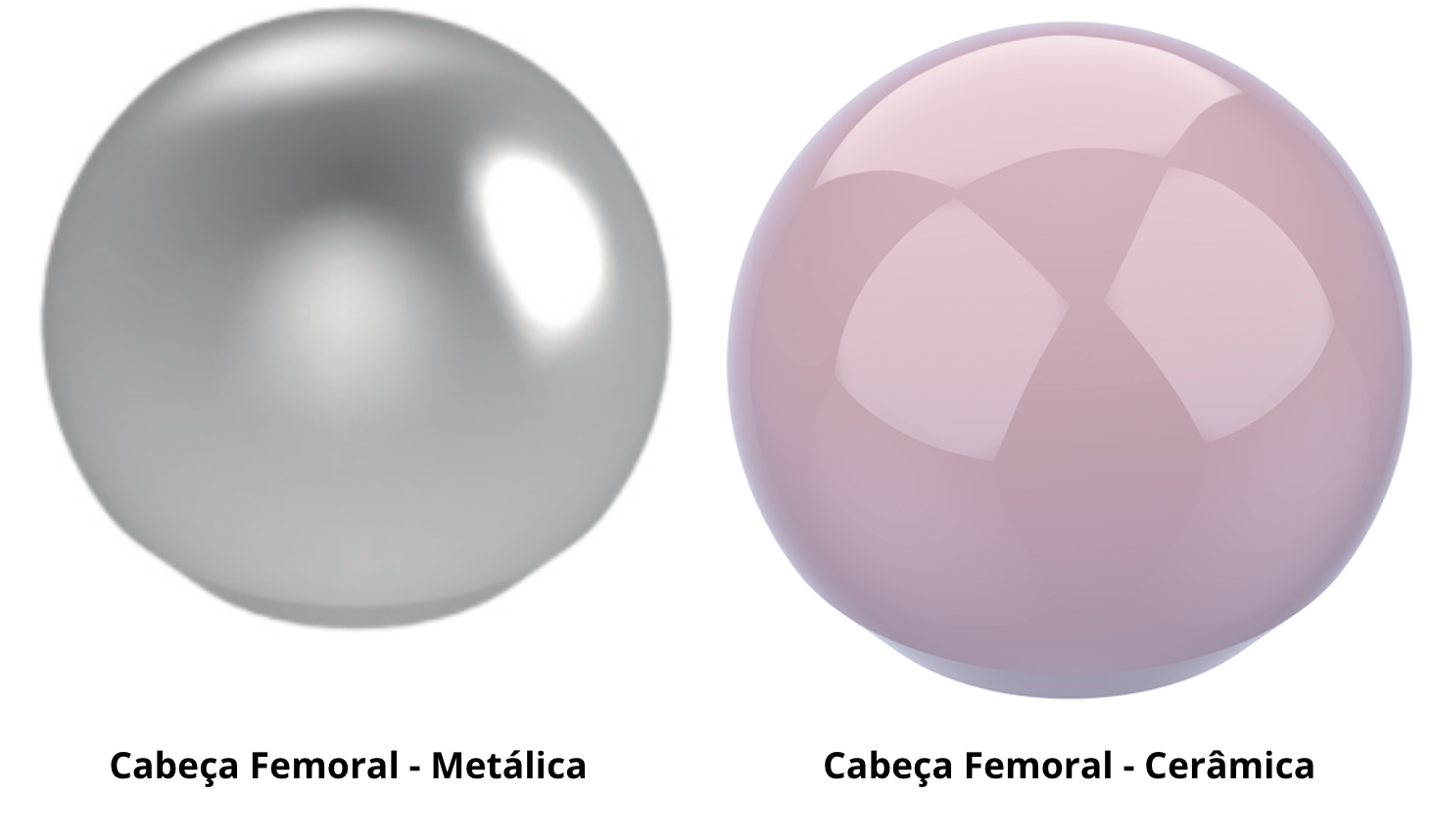 Prótese Total de Quadril 4 cabeca femoral protese quadril