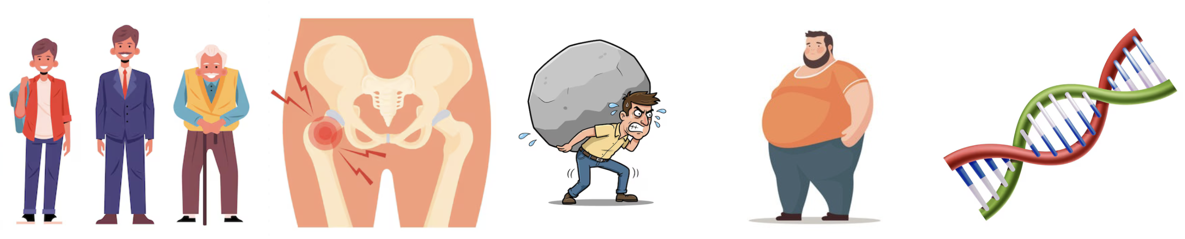 Artrose do Quadril 3 fatores de artrose quadril