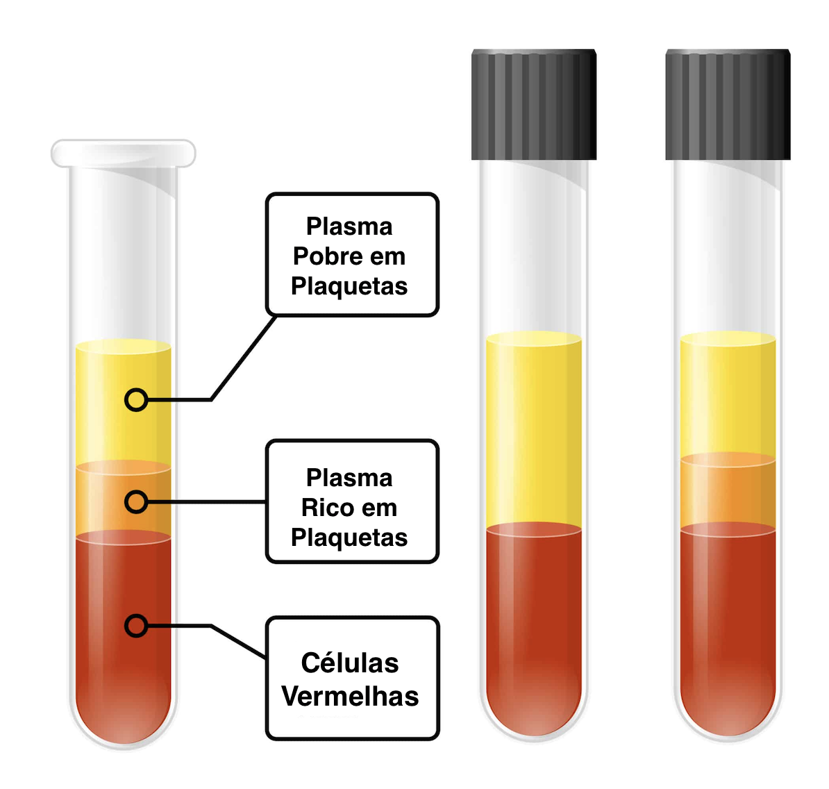 PRP PRP - Plasma rico em plaquetas