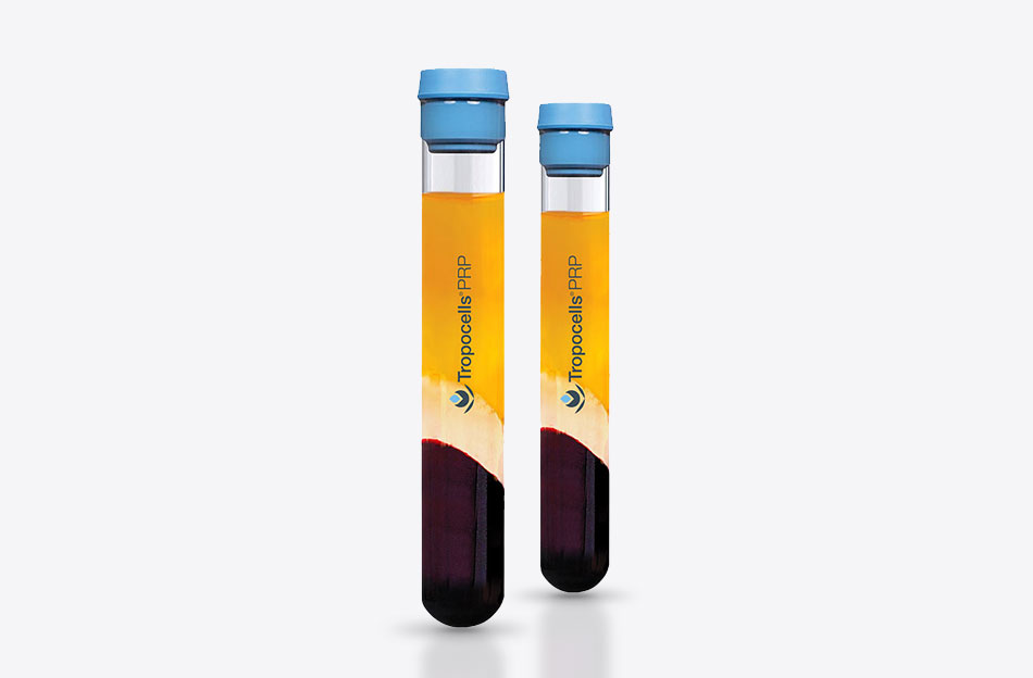 Tropocells PRP Details
